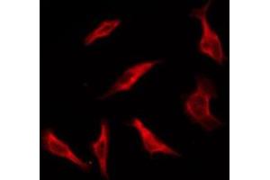 ABIN6276125 staining HT29 by IF/ICC. (OR1S1/1S2 antibody)