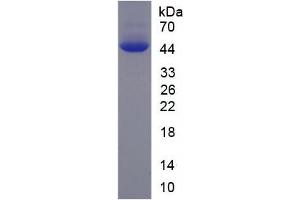 SDS-PAGE analysis of Human PFKM Protein. (PFKM Protein)