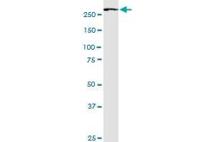 FASN monoclonal antibody (M02), clone 3B3-1D6. (Fatty Acid Synthase antibody  (AA 1-439))