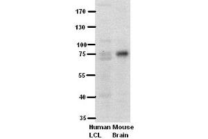 WB Suggested Anti-PFKL Antibody Titration:  5% Milk  ELISA Titer:  dilution: 1:500  Positive Control:  human LCL and mouse brains (PFKL antibody  (Middle Region))