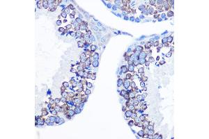 Immunohistochemistry of paraffin-embedded mouse testis using DDX4 Rabbit pAb (ABIN7266705) at dilution of 1:100 (40x lens).