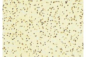 ABIN6276424 at 1/100 staining Mouse brain tissue by IHC-P.
