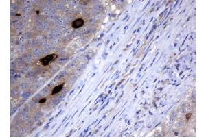 Image no. 2 for anti-Melanoma Antigen Family A, 3 (MAGEA3) antibody (ABIN1499254) (MAGEA3 antibody)