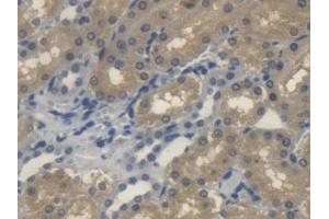 IHC-P analysis of Rat Kidney Tissue, with DAB staining. (Sonic Hedgehog antibody  (AA 237-399))