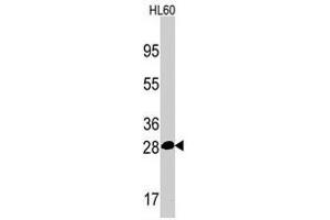 Western blot analysis of PSMA5 polyclonal antibody  in HL-60 cell line lysates (35 ug/lane). (PSMA5 antibody  (Internal Region))