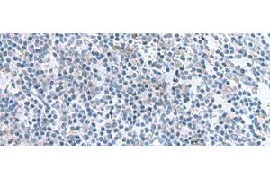 Immunohistochemistry of paraffin-embedded Human tonsil tissue using IL1B Polyclonal Antibody at dilution of 1:55(x200) (IL-1 beta antibody)