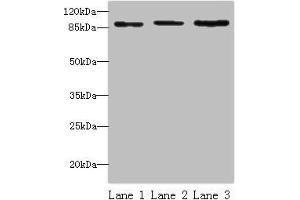 Western blot All lanes: STAT5B antibody at 16 μg/mL Lane 1: HepG2 whole cell lysate Lane 2: K562 whole cell lysate Lane 3: Hela whole cell lysate Secondary Goat polyclonal to rabbit IgG at 1/10000 dilution Predicted band size: 90 kDa Observed band size: 90 kDa (STAT5B antibody  (AA 40-280))