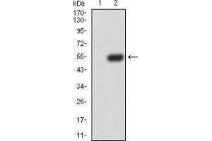 Western Blotting (WB) image for anti-RAB5A, Member RAS Oncogene Family (RAB5A) (AA 1-215) antibody (ABIN5876083) (RAB5 antibody  (AA 1-215))