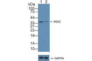 Knockout Varification: Lane 1: Wild-type Hela cell lysate, Lane 2: PEX2 knockout Hela cell lysate, Predicted MW: 35kd Observed MW: 35kd Primary Ab: 5 μg/mL Rabbit Anti-Human PEX2 Antibody Second Ab: 0.