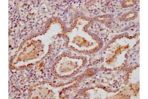 IHC image of ABIN7160293 diluted at 1:300 and staining in paraffin-embedded human lung tissue performed on a Leica BondTM system. (MUC5B antibody  (AA 3929-4106))