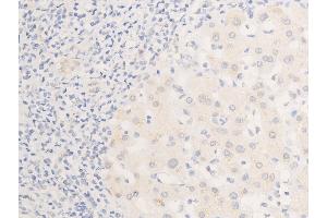 Immunohistochemistry (IHC) image for anti-Epidermal Growth Factor Receptor (EGFR) (pSer1026) antibody (ABIN6254923)