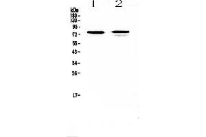 Western blot analysis of FZD3 using anti-FZD3 antibody . (FZD3 antibody)