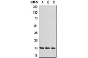 Western blot analysis of ZNF9 expression in MCF7 (A), NIH3T3 (B), Raw264. (CNBP antibody  (Center))