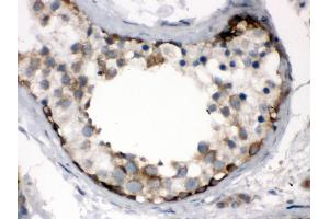 Immunohistochemistry (Paraffin-embedded Sections) (IHC (p)) image for anti-T-Complex 1 (TCP1) (AA 515-551), (C-Term) antibody (ABIN3043417) (TCP1 alpha/CCTA antibody  (C-Term))