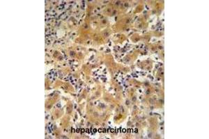 Immunohistochemistry (IHC) image for anti-Ceruloplasmin (Ferroxidase) (CP) antibody (ABIN3003152) (Ceruloplasmin antibody)