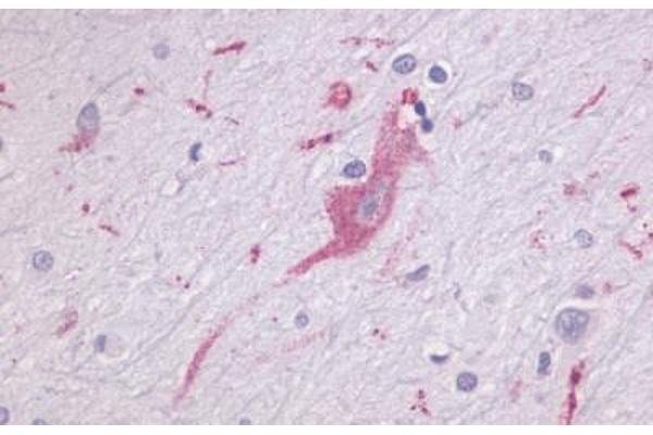 Latrophilin 1 antibody  (N-Term)