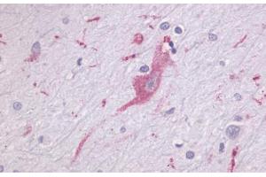 Anti-LPHN1 antibody  ABIN1049022 IHC staining of human brain, neurons and glia.