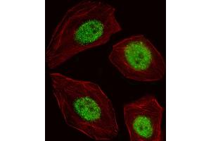 Fluorescent image of A549 cell stained with BLZF1 Antibody (Center) (ABIN653552 and ABIN2842935). (BLZF1 antibody  (AA 156-184))