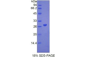 SDS-PAGE analysis of Mouse ANGPTL6 Protein. (ANGPTL6 Protein)