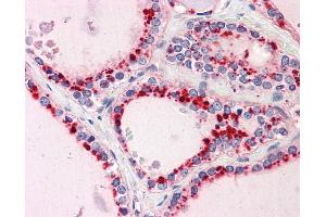 IHC Information: Paraffin embedded thyroid tissue, tested with an antibody dilution of 5 ug/ml.