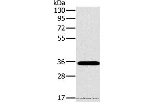 Western blot analysis of Mouse brain tissue, using OTUB1 Polyclonal Antibody at dilution of 1:800 (OTUB1 antibody)