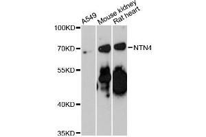 Western blot analysis of extracts of various cell lines, using NTN4 antibody (ABIN6290686) at 1:3000 dilution.