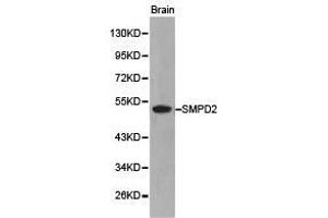 Western Blotting (WB) image for anti-Sphingomyelin phosphodiesterase 2, Neutral Membrane (Neutral Sphingomyelinase) (SMPD2) antibody (ABIN1874877) (SMPD2 antibody)