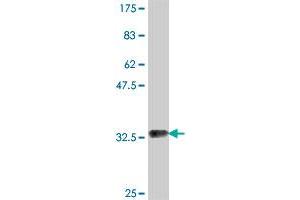 Western Blot detection against Immunogen (35. (ATE1 antibody  (AA 1-87))