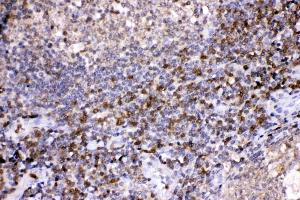 LDHB was detected in paraffin-embedded sections of human tonsil tissues using rabbit anti- LDHB Antigen Affinity purified polyclonal antibody (Catalog # ) at 1 µg/mL. (LDHB antibody  (AA 237-334))