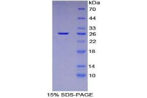 SDS-PAGE analysis of Mouse Nucleoporin 133 kDa Protein. (NUP133 Protein)