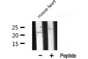 Western blot analysis of CLDN7 expression in Mouse Heart lysate (Claudin 7 antibody  (C-Term))