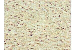 Immunohistochemistry (IHC) image for anti-Neural Precursor Cell Expressed, Developmentally Down-Regulated 1 (NEDD1) (AA 411-660) antibody (ABIN7165859)