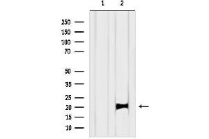 anti-GTPase Kras (KRAS) (C-Term) antibody