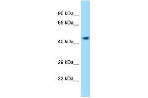 WB Suggested Anti-4732418C07Rik Antibody Titration: 1. (KIAA0494 antibody  (C-Term))