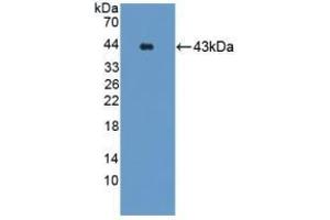 Detection of Recombinant GRPR, Mouse using Polyclonal Antibody to Gastrin Releasing Peptide Receptor (GRPR) (GRPR antibody)