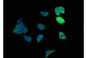 Immunofluorescence staining of HepG2 cells with ABIN7143645 at 1:166, counter-stained with DAPI. (ADH1B antibody  (AA 2-375))