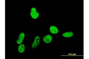 Immunofluorescence of purified MaxPab antibody to GTF2I on HeLa cell. (GTF2I antibody  (AA 1-976))