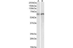 ABIN1782157 (0. (Calreticulin antibody  (Internal Region))