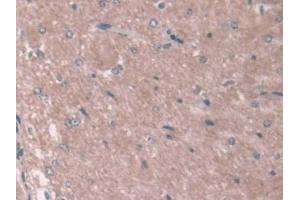 Detection of ASPN in Mouse Cerebrum Tissue using Polyclonal Antibody to Asporin (ASPN) (Asporin antibody  (AA 16-373))