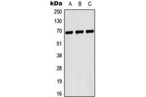 Western blot analysis of CD42b expression in Hela (A), NIH3T3 (B), H9C2 (C) whole cell lysates. (CD42b antibody  (Center))