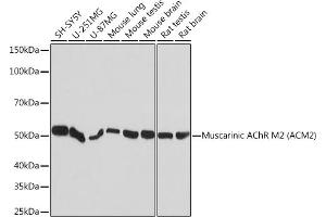 Western blot analysis of extracts of various cell lines, using Muscarinic AChR M2 (Muscarinic AChR M2 ) Rabbit mAb (ABIN7266346) at 1:1000 dilution. (Muscarinic Acetylcholine Receptor M2 antibody)