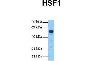 Host:  Rabbit  Target Name:  HSF1  Sample Tissue:  Human Fetal Brain  Antibody Dilution:  1. (HSF1 antibody  (C-Term))