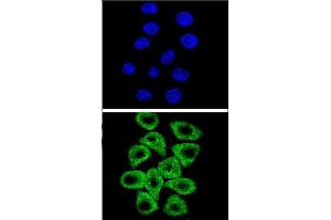 Confocal immunofluorescent analysis of CITED2 Antibody (C-term) (ABIN654133 and ABIN2844005) with Hela cell followed by Alexa Fluor® 489-conjugated goat anti-rabbit lgG (green). (CITED2 antibody  (C-Term))