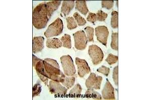 Formalin-fixed and paraffin-embedded human skeletal muscle reacted with Denatured ATG1 Antibody, which was peroxidase-conjugated to the secondary antibody, followed by DAB staining.
