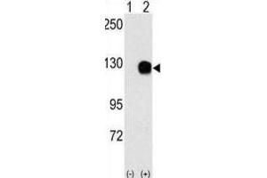 Western Blotting (WB) image for anti-TYRO3 Protein Tyrosine Kinase (TYRO3) antibody (ABIN3003422)