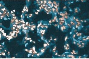 Immunofluorescence staining of a rabbit lung section. (SMARCA2 antibody  (AA 1400-1586))