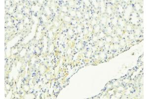 ABIN6268950 at 1/100 staining Mouse kidney tissue by IHC-P. (Dematin antibody  (C-Term))