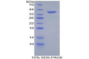 SDS-PAGE (SDS) image for serine Peptidase Inhibitor, Kazal Type 1 (SPINK1) (AA 26-78) protein (His tag,GST tag) (ABIN2123597)