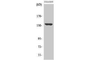Western Blotting (WB) image for anti-MN1 proto-oncogene (MN1) (Internal Region) antibody (ABIN3185603) (Meningioma 1 antibody  (Internal Region))