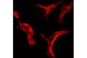 ABIN6274716 staining Hela cells by IF/ICC. (PSMD3 antibody  (C-Term))